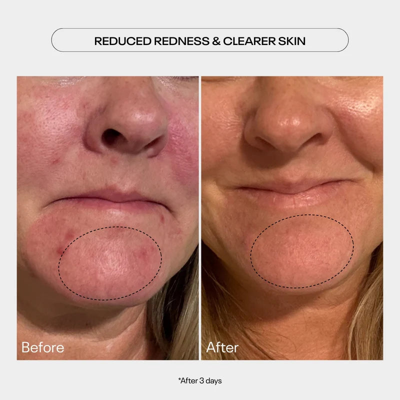 TUEL AHA MOMENT Double Action Resurfacing Serum, 59ml