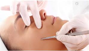 What is dermaplaning?