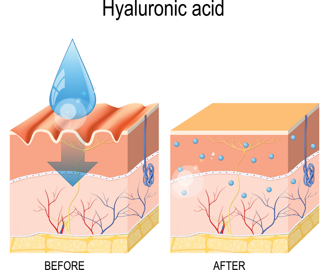 What is Hyaluronic Acid?