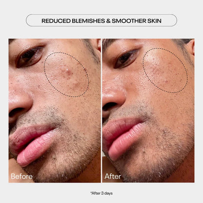 TUEL AHA MOMENT Double Action Resurfacing Serum, 59ml