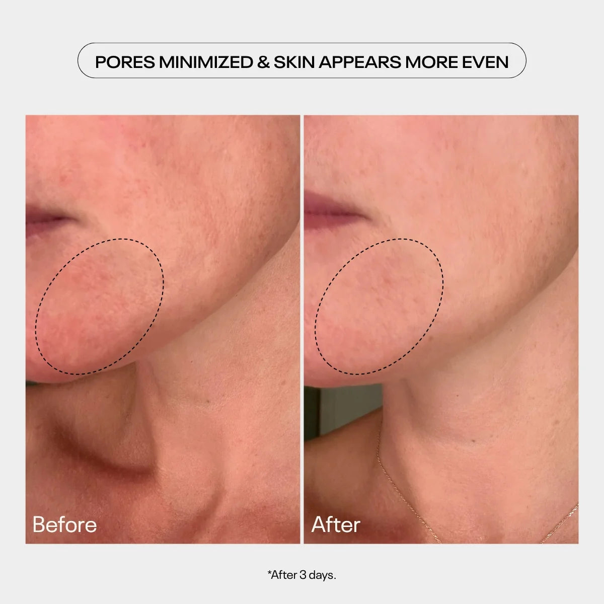 TUEL AHA MOMENT Double Action Resurfacing Serum, 59ml