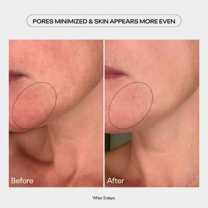 TUEL AHA MOMENT Double Action Resurfacing Serum, 59ml